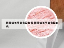 银屑病关节炎有没有书 银屑病关节炎有偏方吗