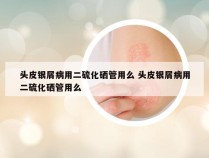 头皮银屑病用二硫化硒管用么 头皮银屑病用二硫化硒管用么