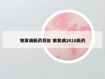 银屑病新药获批 银屑病2018新药