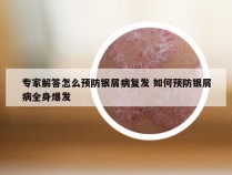 专家解答怎么预防银屑病复发 如何预防银屑病全身爆发