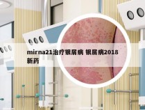 mirna21治疗银屑病 银屑病2018新药