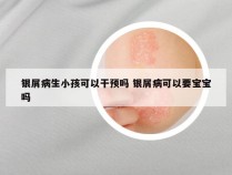 银屑病生小孩可以干预吗 银屑病可以要宝宝吗