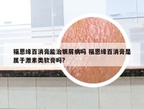 福恩缘百消膏能治银屑病吗 福恩缘百消膏是属于激素类软膏吗?