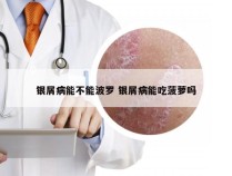 银屑病能不能波罗 银屑病能吃菠萝吗