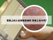 草原上的人会得银屑病吗 草原上有牛吗?