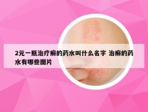 2元一瓶治疗癣的药水叫什么名字 治癣的药水有哪些图片