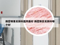 鹤壁哪里皮肤科医院最好 鹤壁新区皮肤科哪个好