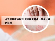 点滴状银屑病前期 点滴状银屑病一般多长时间能好