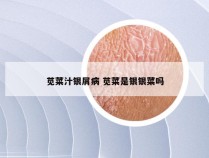 苋菜汁银屑病 苋菜是银银菜吗
