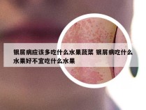 银屑病应该多吃什么水果蔬菜 银屑病吃什么水果好不宜吃什么水果