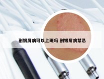 副银屑病可以上班吗 副银屑病禁忌