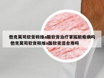 他克莫司软膏和维a酸软膏治疗掌跖脓疱病吗 他克莫司软膏和维a酸软膏混合用吗