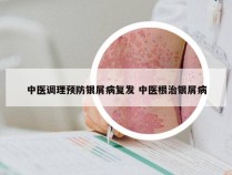 中医调理预防银屑病复发 中医根治银屑病