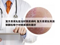 复方青黛丸能治好银屑病吗 复方青黛丸和消银颗粒哪个对银屑病效果好