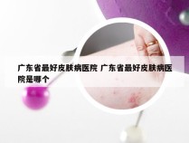 广东省最好皮肤病医院 广东省最好皮肤病医院是哪个