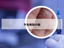 牛皮癣搽69散