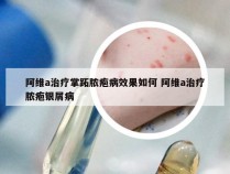 阿维a治疗掌跖脓疱病效果如何 阿维a治疗脓疱银屑病