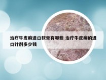 治疗牛皮癣进口软膏有哪些 治疗牛皮癣的进口针剂多少钱