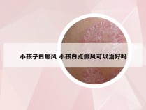 小孩子白癜风 小孩白点癫风可以治好吗