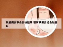 银屑病会不会影响经期 银屑病来月经会加重吗