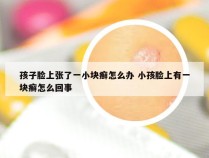 孩子脸上张了一小块癣怎么办 小孩脸上有一块癣怎么回事