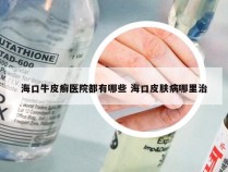 海口牛皮癣医院都有哪些 海口皮肤病哪里治