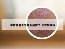 牛皮廨春天为什么厉害了 牛皮廨病因
