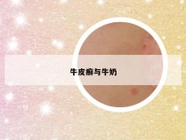 牛皮癣与牛奶