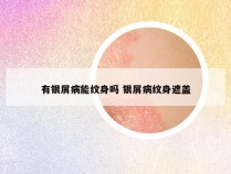 有银屑病能纹身吗 银屑病纹身遮盖