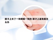膀子上长了一块跟癣一样的 膀子上面有癣怎么办
