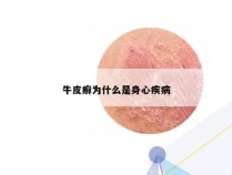 牛皮癣为什么是身心疾病