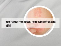 普鲁卡因治疗银屑病吗 普鲁卡因治疗银屑病机制