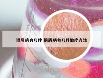 银屑病有几种 银屑病有几种治疗方法