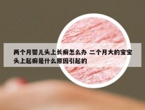 两个月婴儿头上长癣怎么办 二个月大的宝宝头上起癣是什么原因引起的