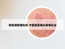 银屑病肺粟粒样 中医银屑病从肺病论治