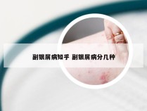 副银屑病知乎 副银屑病分几种
