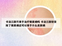 卡泊三醇只用于治疗银屑病吗 卡泊三醇软膏除了银屑病还可以用于什么皮肤病