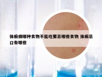 体癣病哪种食物不能吃要忌哪些食物 体癣忌口有哪些