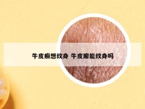 牛皮癣想纹身 牛皮廨能纹身吗
