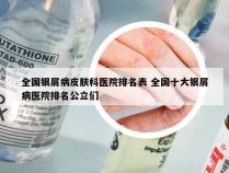 全国银屑病皮肤科医院排名表 全国十大银屑病医院排名公立们