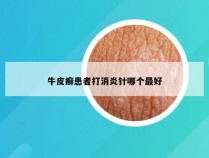 牛皮癣患者打消炎针哪个最好