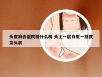 头皮癣去医院挂什么科 头上一层白皮一抠就变头屑