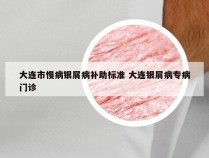 大连市慢病银屑病补助标准 大连银屑病专病门诊