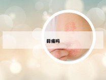 藓痛吗
