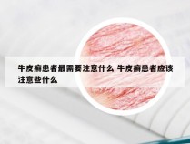 牛皮癣患者最需要注意什么 牛皮癣患者应该注意些什么