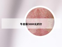 牛皮癣3000元的针
