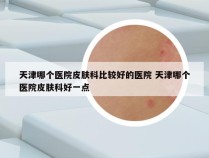 天津哪个医院皮肤科比较好的医院 天津哪个医院皮肤科好一点