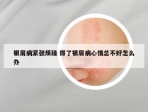 银屑病紧张烦躁 得了银屑病心情总不好怎么办