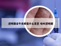 透明图含牛皮癣是什么意思 啥叫透明图