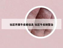 社区开展牛皮癣信息 社区牛皮鲜整治